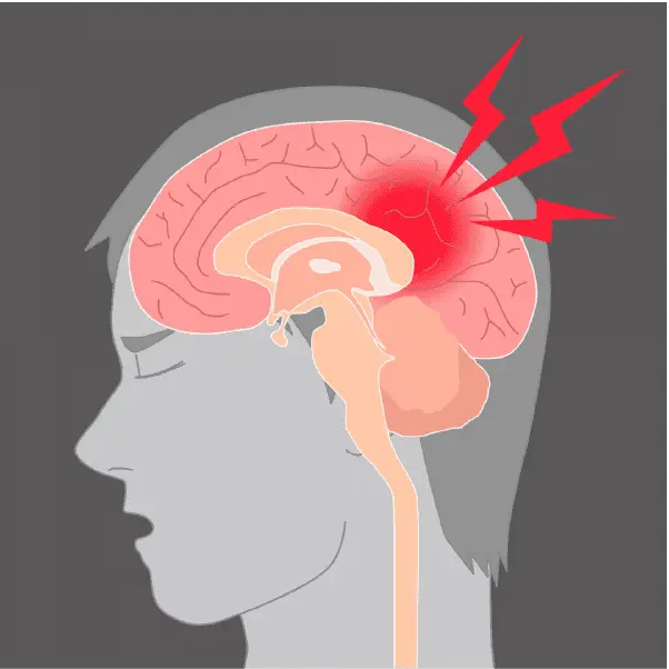 脳梗塞に関する再生医療研究のイメージ図